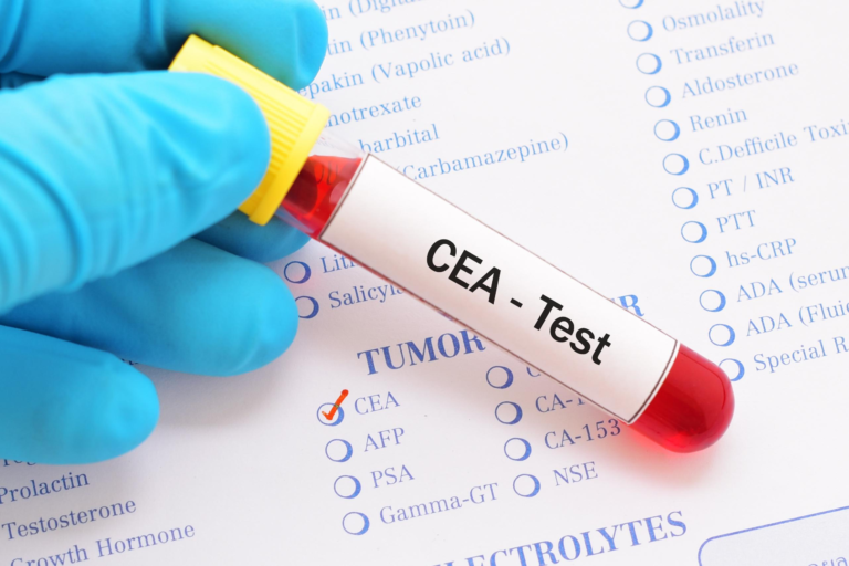 CEA tumor marker blood test for colorectal cancer monitoring