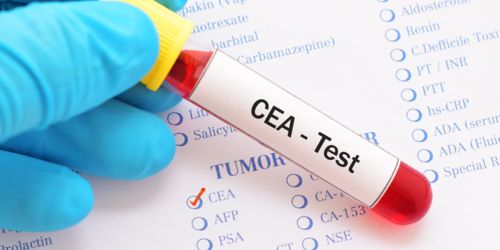 CEA tumor marker blood test for colorectal cancer monitoring