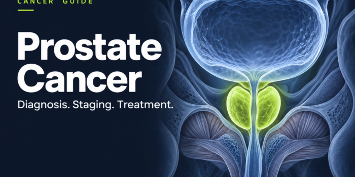 Prostate cancer guide showing an illustration of the prostate below the bladder