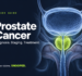 Prostate cancer guide showing an illustration of the prostate below the bladder