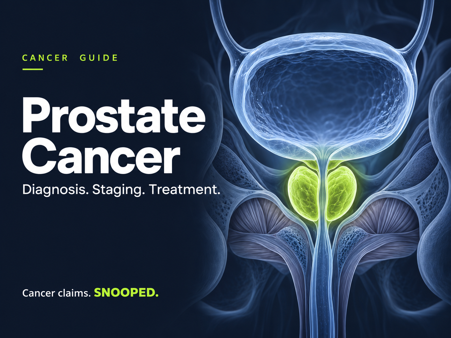 Prostate cancer guide showing an illustration of the prostate below the bladder