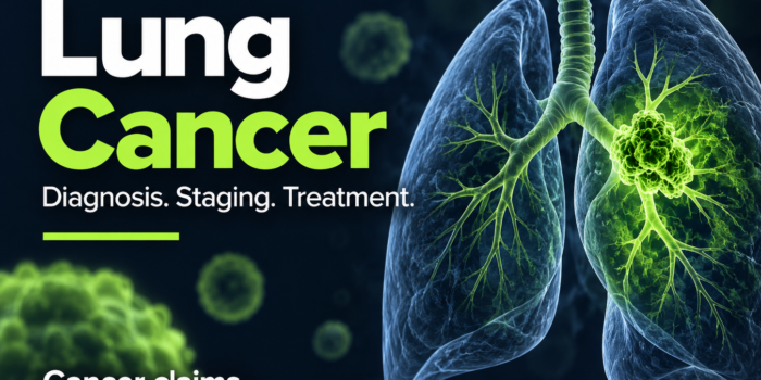 Lung cancer illustration showing the lungs, airways and a tumor