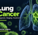 Lung cancer illustration showing the lungs, airways and a tumor