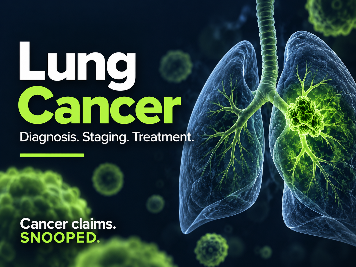 Lung cancer illustration showing the lungs, airways and a tumor